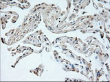 NEUROG1 / NGN1 / Neurogenin 1 Antibody - IHC of paraffin-embedded Ovary tissue using anti-NEUROG1 mouse monoclonal antibody. (Dilution 1:50).
