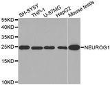 NEUROG1 / NGN1 / Neurogenin 1 Antibody - Western blot analysis of extracts of various cell lines, using NEUROG1 antibody.
