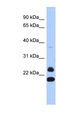 NEUROG2 / NGN2 / Neurogenin 2 Antibody - NEUROG2 / NGN2 antibody Western blot of Fetal Thymus lysate. This image was taken for the unconjugated form of this product. Other forms have not been tested.