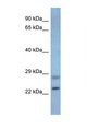 NEUROG3 / NGN3 / Neurogenin 3 Antibody - NEUROG3 / NGN3 antibody Western blot of Mouse Pancreas lysate. Antibody concentration 1 ug/ml.  This image was taken for the unconjugated form of this product. Other forms have not been tested.