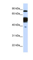 NEXN / Nexilin Antibody - NEXN antibody Western blot of Fetal Liver lysate. This image was taken for the unconjugated form of this product. Other forms have not been tested.