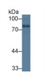 NF-L / NEFL Antibody - Western Blot; Sample: Rat Cerebrum lysate; Primary Ab: 1µg/ml Rabbit Anti-Human NEFL Antibody Second Ab: 0.2µg/mL HRP-Linked Caprine Anti-Rabbit IgG Polyclonal Antibody