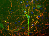 NF-L / NEFL Antibody - Embryonic rat cortical cells grown in tissue culture and stained with NF-L / NEFL antibody (green) and the phosphorylated axonal form of neurofilament NF-H, using NF-H antibody (red). The perikaryal and dendritic neurofilaments in the Large cell in middle are stained with NF-L / NEFL antibody but not with the phosphorylated NF-H antibody. In contrast both antibodies stain axonal neurofilaments which therefore appear orange.