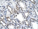 NF45 / ILF2 Antibody - ILF2 antibody ARP35731_T100-NP_004506-ILF2 (interleukin enhancer binding factor 2, 45kDa) Antibody was used in IHC to stain formalin-fixed, paraffin-embedded human kidney.  This image was taken for the unconjugated form of this product. Other forms have not been tested.