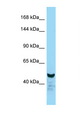 NFAT1 / NFATC2 Antibody - NFATC2 antibody Western blot of Mouse Liver lysate. Antibody concentration 1 ug/ml.  This image was taken for the unconjugated form of this product. Other forms have not been tested.
