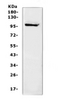 NFAT1 / NFATC2 Antibody - Western blot analysis of NFAT1 using anti-NFAT1 antibody. Electrophoresis was performed on a 5-20% SDS-PAGE gel at 70V (Stacking gel) / 90V (Resolving gel) for 2-3 hours. The sample well of each lane was loaded with 50ug of sample under reducing conditions. Lane 1: human K562 whole cell lysates. After Electrophoresis, proteins were transferred to a Nitrocellulose membrane at 150mA for 50-90 minutes. Blocked the membrane with 5% Non-fat Milk/ TBS for 1.5 hour at RT. The membrane was incubated with rabbit anti-NFAT1 antigen affinity purified polyclonal antibody at 0.5 ug/mL overnight at 4?, then washed with TBS-0.1% Tween 3 times with 5 minutes each and probed with a goat anti-rabbit IgG-HRP secondary antibody at a dilution of 1:10000 for 1.5 hour at RT. The signal is developed using an Enhanced Chemiluminescent detection (ECL) kit with Tanon 5200 system. A specific band was detected for NFAT1 at approximately 100KD. The expected band size for NFAT1 is at 100KD.