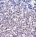 NFATC1 / NFAT2 Antibody - NFATC1 Antibody immunohistochemistry of formalin-fixed and paraffin-embedded human tonsil tissue followed by peroxidase-conjugated secondary antibody and DAB staining.