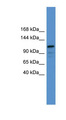 NFATC1 / NFAT2 Antibody - NFATC1 antibody Western blot of COLO205 cell lysate. This image was taken for the unconjugated form of this product. Other forms have not been tested.
