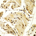 NFATC1 / NFAT2 Antibody - Immunohistochemistry of paraffin-embedded Human esophageal tissue.