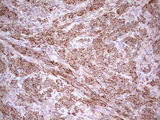 NFS1 Antibody - IHC of paraffin-embedded Human endometrium tissue using anti-NFS1 mouse monoclonal antibody. (Heat-induced epitope retrieval by 1 mM EDTA in 10mM Tris, pH8.5, 120°C for 3min).