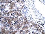 NFYA Antibody - NFYA antibody ARP31263_T100-NP_002496-NFYA (nuclear transcription factor Y, alpha) Antibody was used in IHC to stain formalin-fixed, paraffin-embedded human liver.  This image was taken for the unconjugated form of this product. Other forms have not been tested.