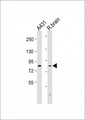 NGEF / EPHEXIN Antibody - All lanes: Anti-NGEF Antibody (N-term) at 1:1000-1:2000 dilution. Lane 1: A431 whole cell lysates. Lane 2: rat brain lysates Lysates/proteins at 20 ug per lane. Secondary Goat Anti-Rabbit IgG, (H+L), Peroxidase conjugated at 1:10000 dilution. Predicted band size: 82 kDa. Blocking/Dilution buffer: 5% NFDM/TBST.