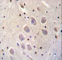 NGFR / CD271 / TNR16 Antibody - CD271 Antibody immunohistochemistry of formalin-fixed and paraffin-embedded human brain tissue followed by peroxidase-conjugated secondary antibody and DAB staining.