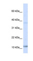 NHLH1 / HEN1 Antibody - NHLH1 antibody NHLH1(nescient helix loop helix 1) Antibody Western blot of Fetal Heart lysate.  This image was taken for the unconjugated form of this product. Other forms have not been tested.