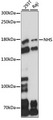 NHS Antibody - Western blot analysis of extracts of various cell lines, using NHS antibody at 1:1000 dilution. The secondary antibody used was an HRP Goat Anti-Rabbit IgG (H+L) at 1:10000 dilution. Lysates were loaded 25ug per lane and 3% nonfat dry milk in TBST was used for blocking. An ECL Kit was used for detection and the exposure time was 30s.