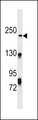 NHSL1 Antibody - NHSL1 Antibody western blot of CEM cell line lysates (35 ug/lane). The NHSL1 antibody detected the NHSL1 protein (arrow).