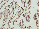 NICN1 Antibody - Immunohistochemistry of paraffin-embedded human lung tissue using antibody at dilution of 1:100.