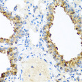 NIN / Ninein Antibody - Immunohistochemistry of paraffin-embedded mouse lung using NIN antibody at dilution of 1:100 (x40 lens).