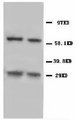 NIP3 / BNIP3 Antibody -  This image was taken for the unconjugated form of this product. Other forms have not been tested.