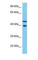 NIP45 / NFATC2IP Antibody - Western blot of NF2IP Antibody with human 721_B Whole Cell lysate.  This image was taken for the unconjugated form of this product. Other forms have not been tested.