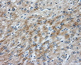NIT2 Antibody - IHC of paraffin-embedded liver tissue using anti-NIT2 mouse monoclonal antibody. (Dilution 1:50).