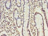 NK1 / CD160 Antibody - Immunohistochemistry of paraffin-embedded human small intestine using antibody at 1:100 dilution.  This image was taken for the unconjugated form of this product. Other forms have not been tested.