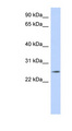 NKAIN4 / C20orf58 Antibody - NKAIN4 antibody Western blot of MCF7 cell lysate. This image was taken for the unconjugated form of this product. Other forms have not been tested.