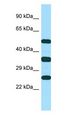 NKG2DL4 / ULBP4 Antibody - NKG2DL4 / ULBP4 antibody Western Blot of MCF7.  This image was taken for the unconjugated form of this product. Other forms have not been tested.