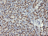 NKIRAS1 Antibody - IHC of paraffin-embedded Human pancreas tissue using anti-NKIRAS1 mouse monoclonal antibody.
