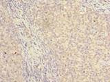 NKIRAS2 Antibody - Immunohistochemistry of paraffin-embedded human tonsil tissue using antibody at dilution of 1:100.