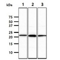 NKP30 Antibody - The cell lysates (40ug) were resolved by SDS-PAGE, transferred to PVDF membrane and probed with anti-human NCR3 antibody (1:1000). Proteins were visualized using a goat anti-mouse secondary antibody conjugated to HRP and an ECL detection system. Lane 1.: THP-1 cell lysate Lane 2.: Ramos cell lysate Lane 3.: TF-1 cell lysate