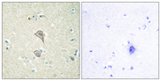 NKTR Antibody - Immunohistochemistry analysis of paraffin-embedded human brain tissue, using NKTR Antibody. The picture on the right is blocked with the synthesized peptide.