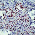 NKX2-1 / Thyroid-Specific TF Antibody - Formalin-fixed, paraffin-embedded rat lung stained with peroxidase-conjugate and AEC chromogen. Note nuclear staining of alveolar epithelial cells.  This image was taken for the unmodified form of this product. Other forms have not been tested.