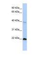 NKX3-2 / BAPX1 Antibody - NKX3-2 / BAPX1 antibody Western blot of HepG2 cell lysate. This image was taken for the unconjugated form of this product. Other forms have not been tested.