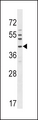 NKX6-1 Antibody - NKX6-1 Antibody western blot of A549 cell line lysates (35 ug/lane). The NKX6-1 antibody detected the NKX6-1 protein (arrow).
