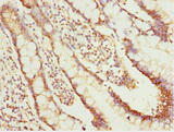 NLE1 Antibody - Immunohistochemistry of paraffin-embedded human small intestine tissue at dilution 1:100