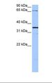 NLGN4X / KIAA1260 Antibody - Hela cell lysate. Antibody concentration: 1.0 ug/ml. Gel concentration: 12%.  This image was taken for the unconjugated form of this product. Other forms have not been tested.