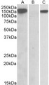 NLRP2 / NALP2 Antibody - HEK293 lysate (10ug protein in RIPA buffer) overexpressing Human NLRP2 with DYKDDDDK tag probed with (1ug/ml) in Lane A and probed with anti- DYKDDDDK Tag (1/5000) in lane C. Mock-transfected HEK293 probed (1mg/ml) in Lane B. Primary