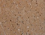 NLRP9 Antibody - Immunohistochemistry of paraffin-embedded Human brain using NLRP9 Polyclonal Antibody at dilution of 1:40.
