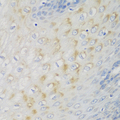 NME4 Antibody - Immunohistochemistry of paraffin-embedded human esophagus using NME4 antibody at dilution of 1:100 (40x lens).