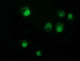 NMNAT1 / NMNAT Antibody - Anti-NMNAT1 mouse monoclonal antibody immunofluorescent staining of COS7 cells transiently transfected by pCMV6-ENTRY NMNAT1.