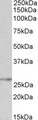 NMNAT3 Antibody - NMNAT3 antibody (0.1 ug/ml) staining of Human Kidney lysate (35 ug protein in RIPA buffer). Primary incubation was 1 hour. Detected by chemiluminescence.