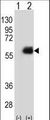 NMT2 Antibody - Western blot of NMT2 (arrow) using rabbit polyclonal NMT2 Antibody (E31). 293 cell lysates (2 ug/lane) either nontransfected (Lane 1) or transiently transfected (Lane 2) with the NMT2 gene.