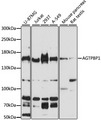 NNA1 / AGTPBP1 Antibody - Western blot analysis of extracts of various cell lines, using AGTPBP1 antibody at 1:3000 dilution. The secondary antibody used was an HRP Goat Anti-Rabbit IgG (H+L) at 1:10000 dilution. Lysates were loaded 25ug per lane and 3% nonfat dry milk in TBST was used for blocking. An ECL Kit was used for detection and the exposure time was 60s.