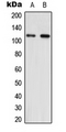 NNT Antibody - Western blot analysis of NNT expression in HEK293T (A); NIH3T3 (B) whole cell lysates.