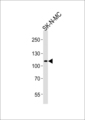 NOC3L Antibody - Western blot of lysate from SK-N-MC cell line, using NOC3L Antibody. Antibody was diluted at 1:1000 at each lane. A goat anti-rabbit IgG H&L (HRP) at 1:5000 dilution was used as the secondary antibody. Lysate at 35ug per lane.