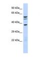 NOC4L Antibody - Western blot of Human Fetal Brain. NOC4L antibody dilution 1.0 ug/ml.  This image was taken for the unconjugated form of this product. Other forms have not been tested.