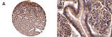 NOD2 / CARD15 Antibody - Formalin-fixed, paraffin-embedded normal human colon stained for NOD2 expression using Polyclonal Antibody to NOD2/CARD15 at 1:2000. A, tissue core from a colon tissue microarray. A1, high magnification of A. Hematoxylin-Eosin counterstain.