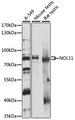 NOL11 Antibody - Western blot analysis of extracts of various cell lines, using NOL11 antibody at 1:1000 dilution. The secondary antibody used was an HRP Goat Anti-Rabbit IgG (H+L) at 1:10000 dilution. Lysates were loaded 25ug per lane and 3% nonfat dry milk in TBST was used for blocking. An ECL Kit was used for detection and the exposure time was 1s.