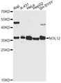 NOL12 Antibody - Western blot analysis of extracts of various cell lines, using NOL12 antibody at 1:3000 dilution. The secondary antibody used was an HRP Goat Anti-Rabbit IgG (H+L) at 1:10000 dilution. Lysates were loaded 25ug per lane and 3% nonfat dry milk in TBST was used for blocking. An ECL Kit was used for detection and the exposure time was 90s.